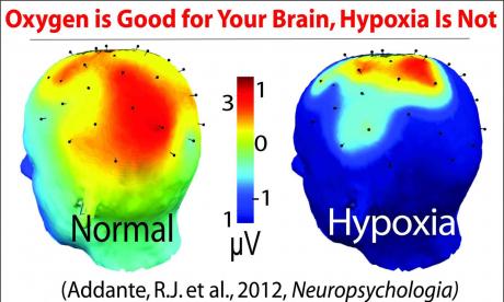 Addant RJ et al (Neuropsychologia, 2012)